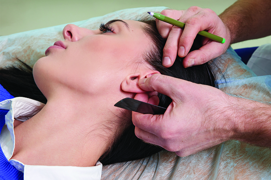 chirurgie esthetique visage montpellier chirurgie esthetique visage montpellier